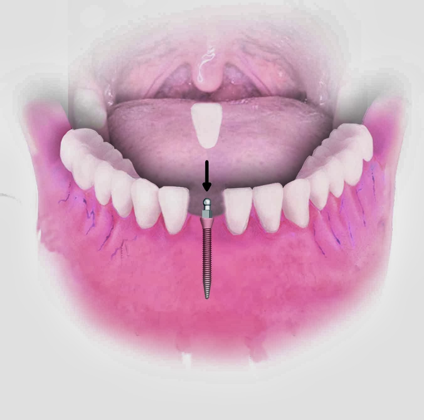 Dental Implant Solutions of Clinton Township MI — photo